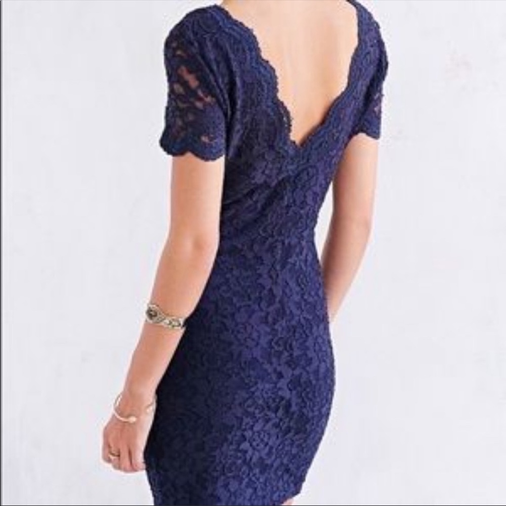 UO Kimchi Blue Scallop Lace Bodycon Dress